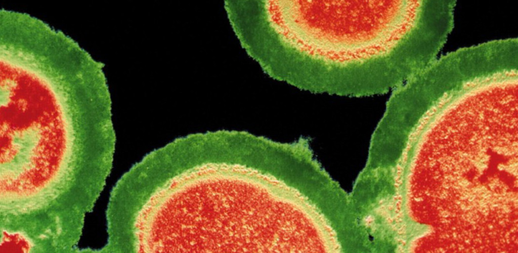 MRSA and C. difficile