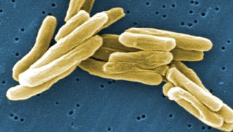 Totally drug-resistant tuberculosis found in India