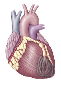 Complex heart surgeries made Safer
