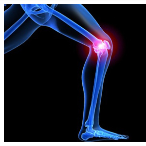 India Is Likely to See Endemic of Osteoarthritis by 2013