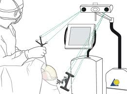Apollo Performs Indias First Navigation Surgery for Maxillofacial Trauma