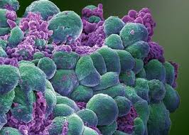 New lease of life for cancer affected organs