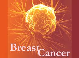 Osteoporosis drug stops growth of breast cancer cells, even in resistant tumors