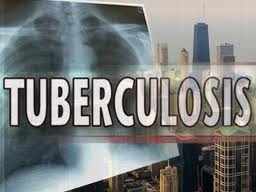 Now multi-drug-resistant TB stock crisis looms