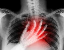 Heart Failure linked to Air Pollution