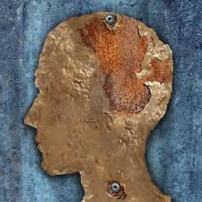 Should cancer screening be stopped as dementia progresses?