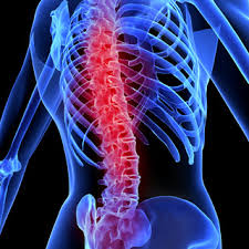 Recommended irradiation dose and time window of local x-ray for spinal cord injury