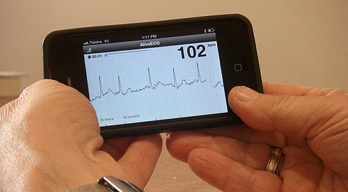 i Phone Device Detects Heart Rhythm Problem That Can Cause Stroke