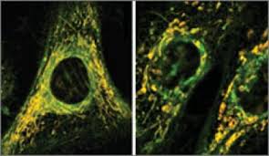 How Oxidative Stress and Mitochondrial Damage Relate to Neurodegenerative Diseases