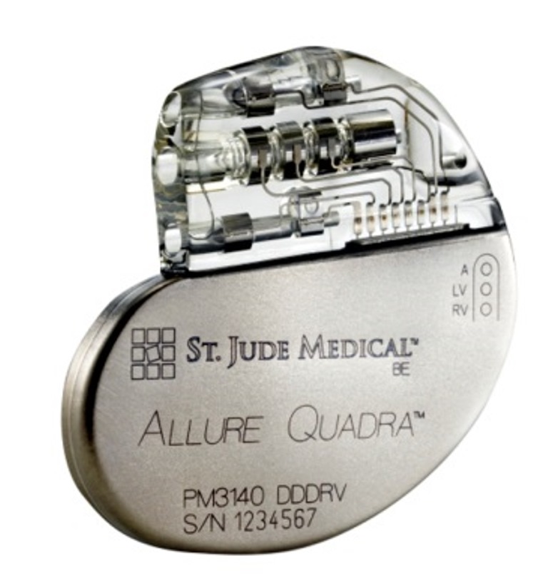 St. Jude Medical Announces First Implant of Next Generation Quadripolar Pacemaker in India