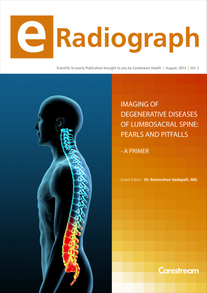 Spinal Imaging Complexities Demystified in the Second Edition of e-Radiograph