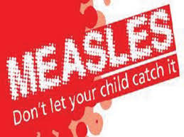 Measles elimination by 2020
