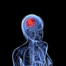 A Potential New Treatment Option For Patients With Brain Cancer