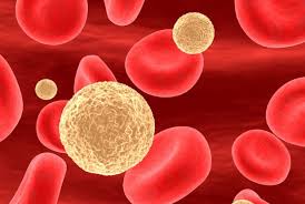 Researchers Uncover Genetic Cause of Childhood Leukemia
