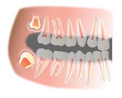 STEMADE – INDIAS FIRST DENTAL STEM CELL BANK , PLANS TO OPERATE IN 50 CITIES IN INDIA