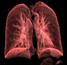 Clinical tool Accurately Classifies Benign and Malignant Spots on Lung Scans of Smokers