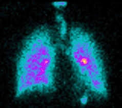 Saket City Hospital Observes International Day Of Radiology