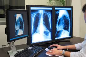 Imaging Technology to Improve Survival of Ischemic Disease Patients