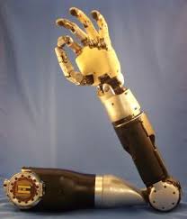 Bionic arm can catch objects on the fly