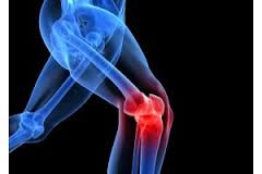 Rising cases of arthritis among young worry docs