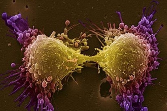 New tech developed to diagnose cancer cells