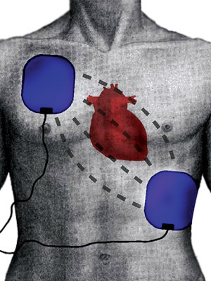 Latest Breakthrough in Cardiac Care