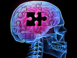 Think You Have Alzheimer’s?