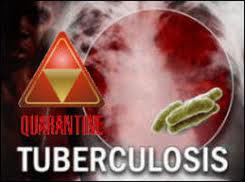Breath test for Tuberculosis