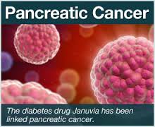 Researchers recognize early signs of Pancreatic cancer
