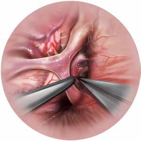New tool assesses skill development in robotic microsurgery
