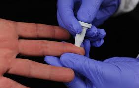 Researchers discover fast, finger-prick Ebola test