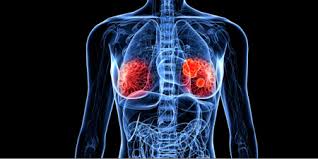 California hospital explores genetics-aided cancer cure