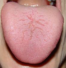 Tongue is a new diagnostic tool!