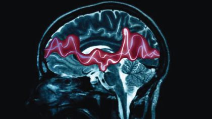 AIIMS, NBRC Set Up Advanced Epilepsy Neurobiology Lab