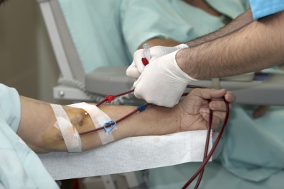 AV Fistula Incision for Patients Undergoing Hemodialysis
