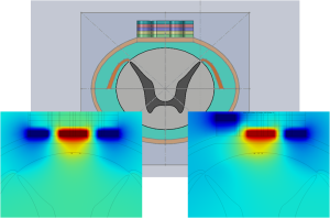 [[Using the idea above, create collage from Figure4Top, Figure4Left and Figure4Right]] Figure 4. Slice plot and contour values of electric field projecting into the spinal  cord. Left: control with no scar. Right: Scar under left electrode reduces proper field  symmetry. Contrary to expectation, scar can result in higher field values projecting into  the spinal cord and too much stimulation.