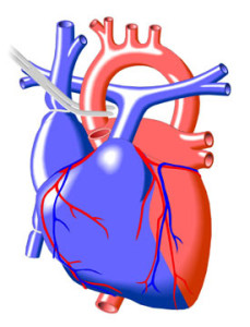 Heart