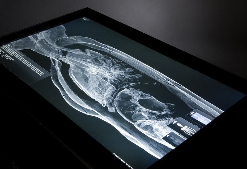 Technology to enable AIIMS conduct virtual autopsies soon
