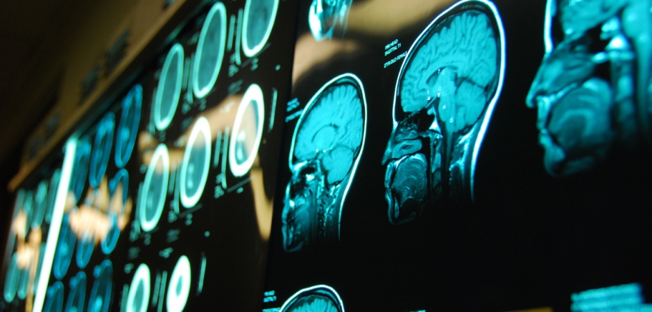 AIIMS launches robotic arm for neurosurgeries