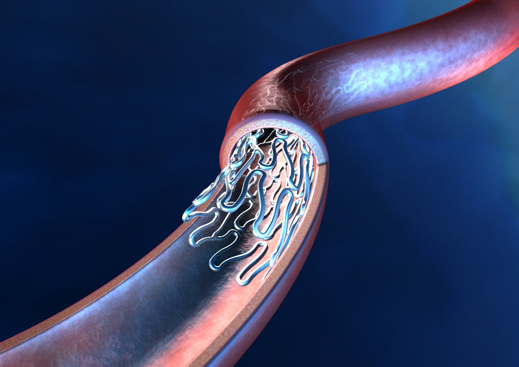 Govt asks stent manufacturers to disclose detailed pricing data