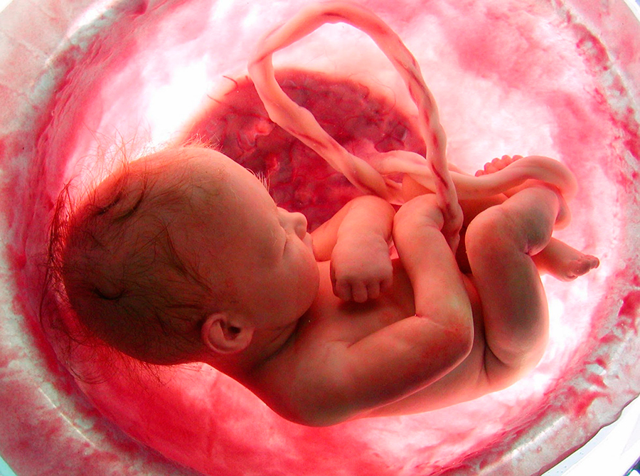 Milann first hospital to get ICMR approval for uterus transplant