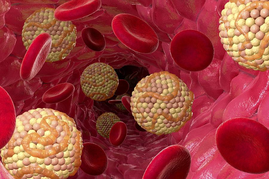 Zydus Ahmedabad plant to produce anti-cholesterol tablet for US market