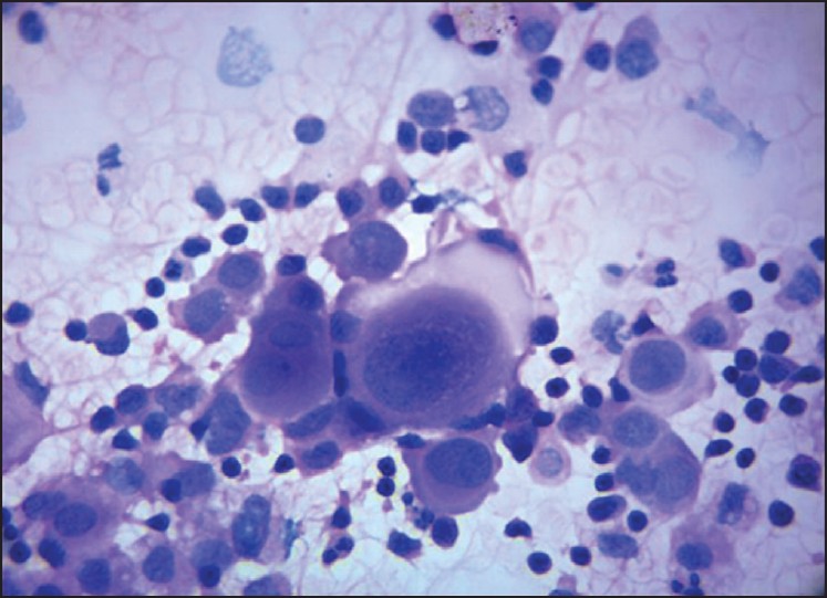 Cell cannibalism may slow, prevent cancer