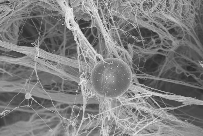Computer simulation shows how cells feel their surroundings