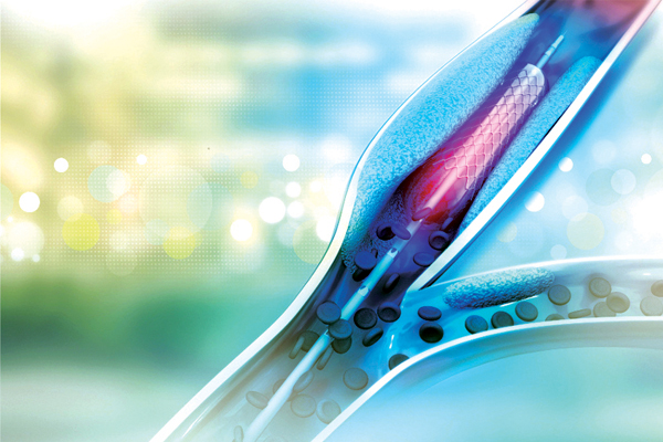 Medical Equipment and Diagnostics: The Affordability Factor