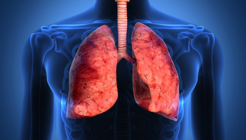 Healthy lifestyle key to prevent lung cancer