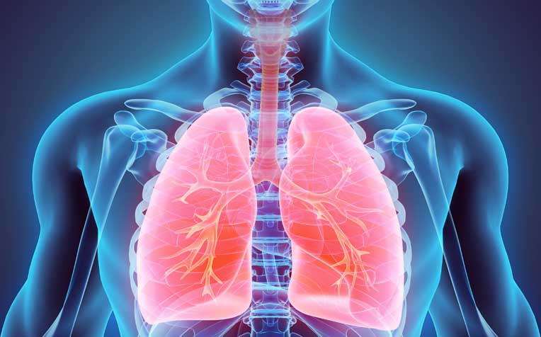 UP takes up cudgels against tuberculosis