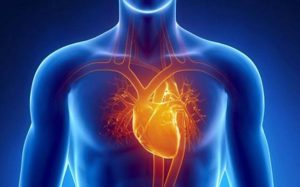 Brugada Syndrome