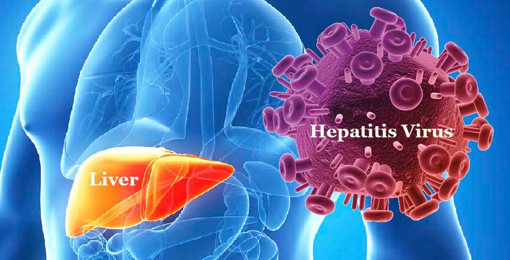 World Hepatitis Day: Timely diagnosis, treatment need of the hour