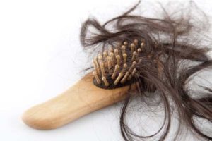 hair loss